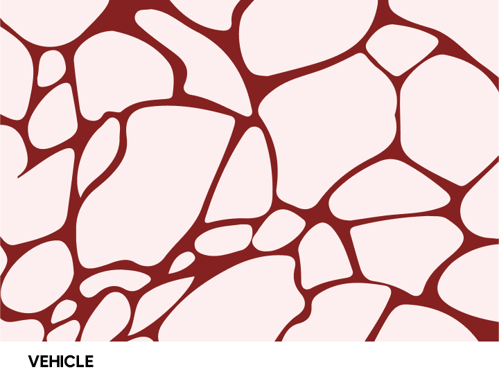 지방분해 애니메이션