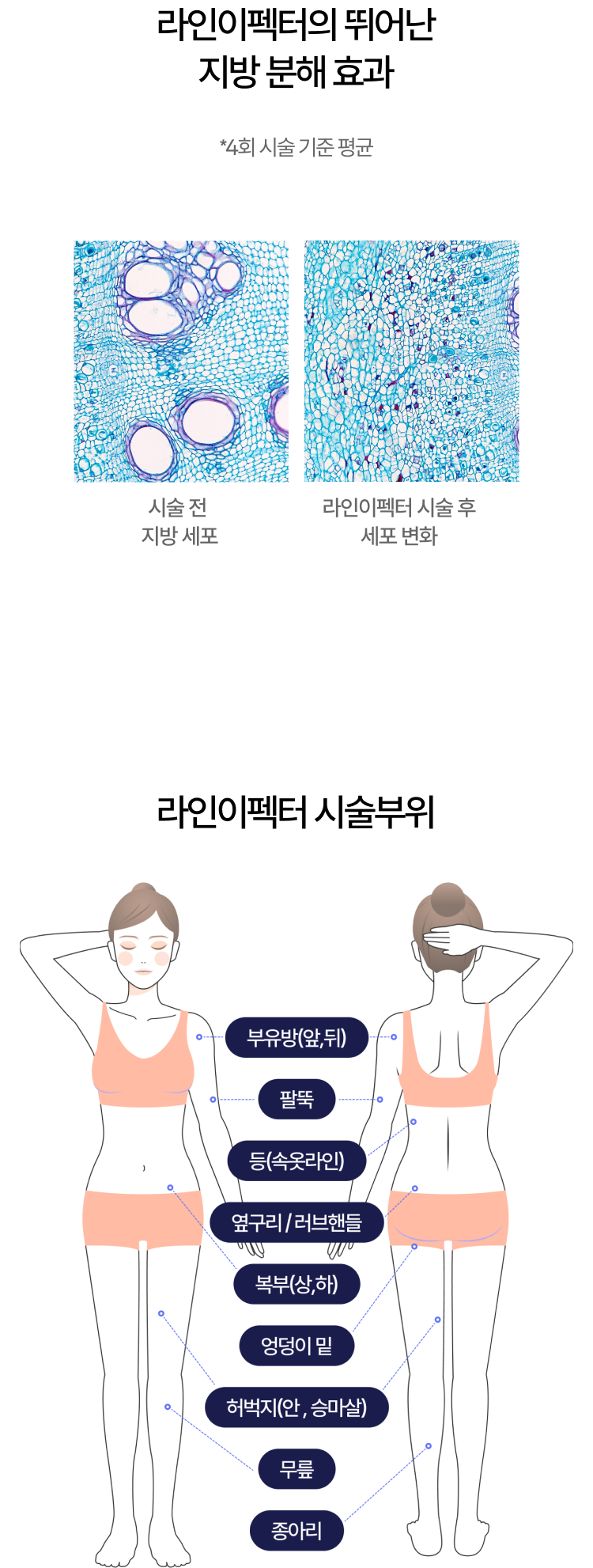 라인이펙터의 뛰어난 분해효과